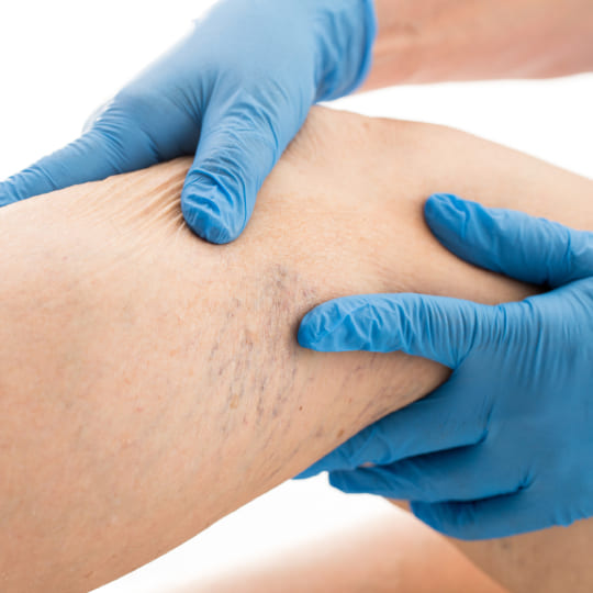 Angiologia y cirugia vascular