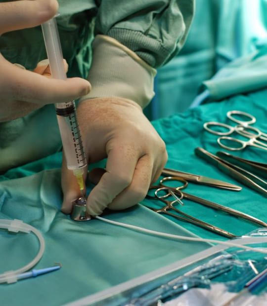 Catéter para quimioterapia