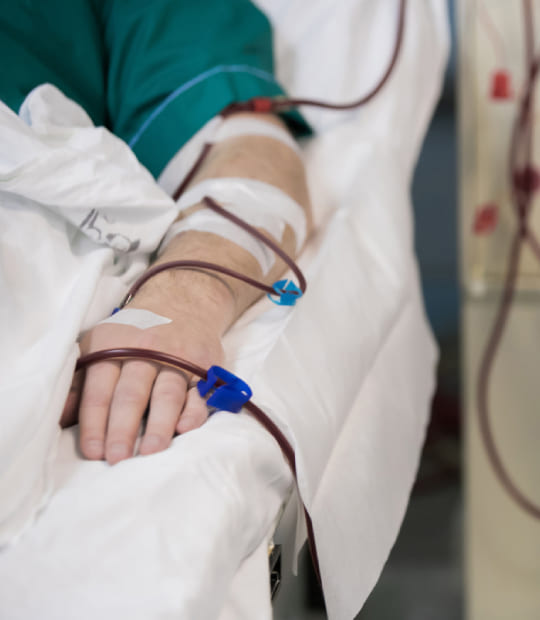 Fistulas para hemodiálisis